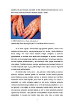 Referāts 'Cilvēka ģenētika. Mutācijas un hromosomu pārveidnes', 3.