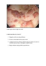 Konspekts 'Kapoši sarkoma', 5.
