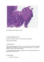 Konspekts 'Kapoši sarkoma', 7.