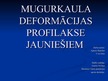Prezentācija 'Mugurkaula deformācijas profilakse jauniešiem', 1.