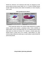 Diplomdarbs 'Māsas un pacientu viedoklis par sadarbību un māsas pienākumiem Rīgas un Latgales', 35.