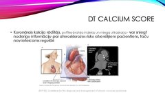 Prezentācija 'Stabilas koronāro artēriju slimības diagnostika', 29.