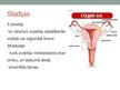 Prezentācija 'Dzemdes ķermeņa jeb endometrija vēzis', 10.
