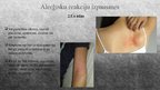 Prezentācija 'Alerģija pret dzīvniekiem un tās ietekme uz organismu', 5.