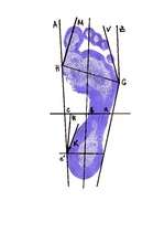 Konspekts 'Pēdas stāvokļa noteikšana sporta medicīnā', 2.