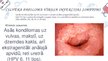 Prezentācija 'Sievietes ārējo un iekšējo dzimumorgānu iekaisumi, kurus izraisa specifiska mikr', 4.