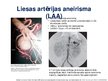 Prezentācija 'Viscerālo artēriju aneirismas', 2.
