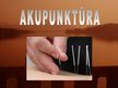 Prezentācija 'Akupunktūra', 1.