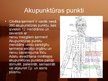 Prezentācija 'Akupunktūra', 4.
