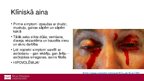 Prezentācija 'Ebolas vīrusslimība jeb Ebolas hemorāģiskais drudzis', 10.