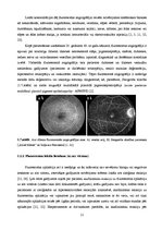 Diplomdarbs 'Lielmolekulārā un mazmolekulārā fluoresceīna pielietojamības salīdzinājums optom', 16.