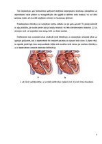 Referāts 'Reanimācijas iekārta - defibrilators', 5.