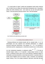 Referāts 'Reanimācijas iekārta - defibrilators', 10.
