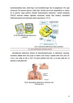 Referāts 'Reanimācijas iekārta - defibrilators', 19.