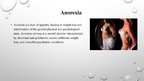 Prezentācija 'Eating Disorders: Anorexia', 2.