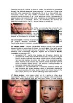 Konspekts 'Ādas slimības, kas skar sejas ādu', 3.