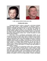 Konspekts 'Gēnu mutācijas, hromosomālās pārveidnes, multifaktoriālās slimības', 4.