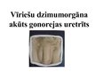 Prezentācija 'Vīriešu dzimumorgāna akūts gonorejas uretrīts', 1.