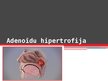 Prezentācija 'Adenoīdu hipertrofija', 1.