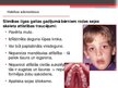 Prezentācija 'Adenoīdu hipertrofija', 8.