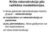 Prezentācija 'Krūts dziedzera ļaundabīgie audzēji, to diagnostika, ārstēšana', 13.
