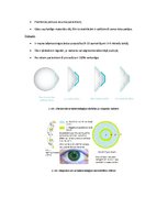 Konspekts 'Redzes korekcijas veids - kontaktlēcas', 3.