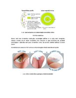 Konspekts 'Redzes korekcijas veids - kontaktlēcas', 4.