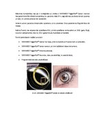 Konspekts 'Redzes korekcijas veids - kontaktlēcas', 9.