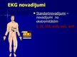 Prezentācija 'EKG pamati, dzīvībai bīstamie ritmi', 5.