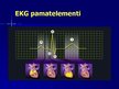 Prezentācija 'EKG pamati, dzīvībai bīstamie ritmi', 13.