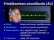 Prezentācija 'EKG pamati, dzīvībai bīstamie ritmi', 38.