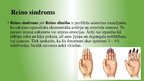 Prezentācija 'Reino sindroms', 2.