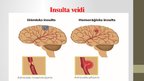 Prezentācija 'Insults, riska faktori, profilakse', 14.