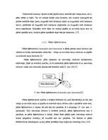 Referāts 'Hiperpronācijas novēršana, izmantojot dažādas pēdu ortozes', 13.