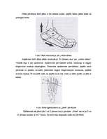 Referāts 'Hiperpronācijas novēršana, izmantojot dažādas pēdu ortozes', 36.