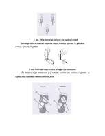 Referāts 'Hiperpronācijas novēršana, izmantojot dažādas pēdu ortozes', 37.
