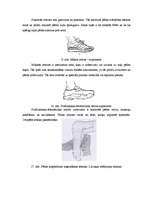 Referāts 'Hiperpronācijas novēršana, izmantojot dažādas pēdu ortozes', 39.