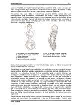 Referāts 'Tārpi', 15.