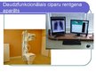 Prezentācija 'Fizika - mūsdienu medicīnas sastāvdaļa', 8.