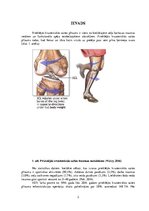 Referāts 'Preventīvie pasākumi, lai novērstu priekšējās krusteniskās saites plīsuma riskus', 3.