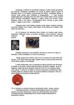 Referāts 'Ultraskaņa', 6.