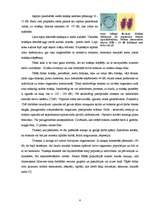 Referāts 'Troksnis - tā iedarbība uz dzirdi', 4.