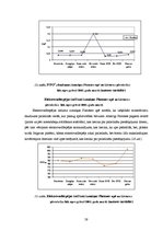 Diplomdarbs 'Pārrobežu piesārņojums jutīgā teritorijā: Platones upes baseins', 59.