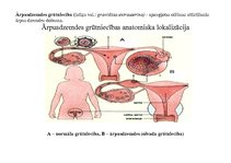 Konspekts 'Ektopiskas grūtniecības anatomiska lokalizācija', 2.