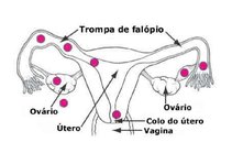 Konspekts 'Ektopiskas grūtniecības anatomiska lokalizācija', 3.