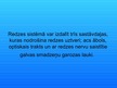 Prezentācija 'Cilvēka redzes sensorā sistēma', 2.