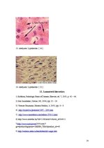 Referāts 'Šūnas novecošana', 19.