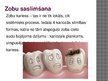 Prezentācija 'Zobu veselības dažādi aspekti', 5.