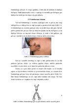 Referāts 'Fonendoskops', 9.