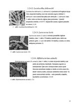 Referāts 'Bifido un lakto baktēriju sastopamība atsevišķos skābpiena produktos un to ietek', 13.